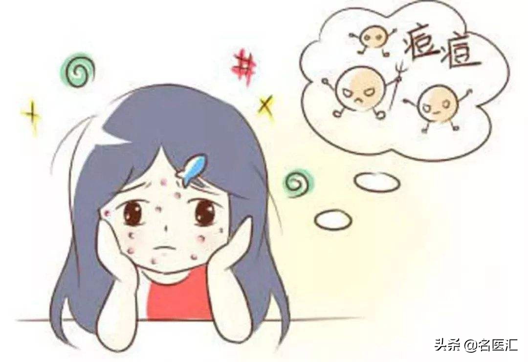 关于痘痘，你最想知道的几个问题（附答案）